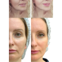 Микротоковый RF лифтинг-массажёр для лица MEDICA+ Skin Lifting 7.0 White - EMS, LED