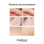 Фотоэпилятор Haircleaner 5.0 MEDICA+ Япония IPL
