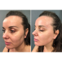 Микротоковый лифтинг-массажер для тела MEDICA+ Skin Lifting 6.0 white