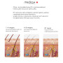 Фотоепілятор охолоджуючий MEDICA+ ICE PRO 10X