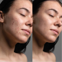 Вакуумный очиститель кожи и пор MEDICA+ SKINCLEANER 9.0 WT