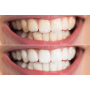 Отбеливающая капа для зубов MEDICA+ WhitePearl 10X Black