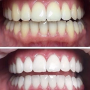 Ультразвуковая зубная щетка Medica+ PROBRUSH 9.0 white