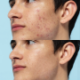Ультразвуковой скраббер для кожи лица Medica+ Vibroskin 5.0